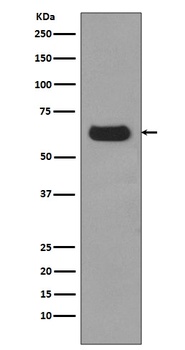 Anti-p62/SQSTM1 Rabbit Monoclonal Antibody
