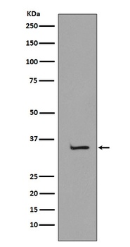 TBP/Tata Binding Protein Tbp Rabbit Monoclonal Antibody
