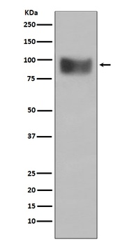 Anti-Interferon Receptor alpha IFNAR1 Rabbit Monoclonal Antibody
