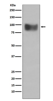 Interferon Receptor alpha IFNAR1 Rabbit Monoclonal Antibody