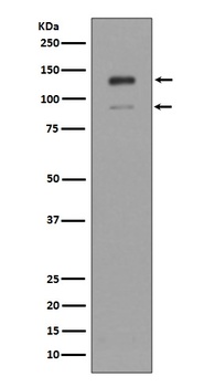 Anti-IFNAR1/Beta R1 Rabbit Monoclonal Antibody