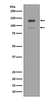 IFNAR1/Beta R1 Rabbit Monoclonal Antibody