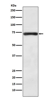 Anti-BACE1/Bace Rabbit Monoclonal Antibody