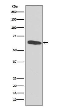 HDAC2/Histone Deacetylase 2 Rabbit Monoclonal Antibody