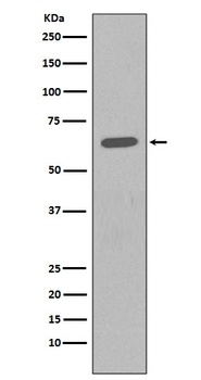 HDAC2/Histone Deacetylase 2 Rabbit Monoclonal Antibody