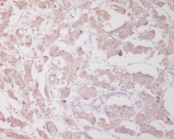 Anti-Beclin 1 BECN1 Monoclonal Antibody
