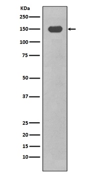 CD11c ITGAX Rabbit Monoclonal Antibody