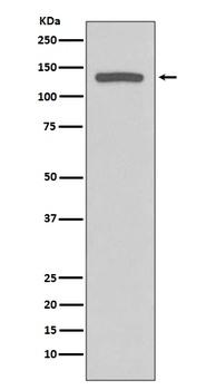 iNOS NOS2 Rabbit Monoclonal Antibody