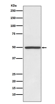 Dopamine Transporter SLC6A3 Rabbit Monoclonal Antibody