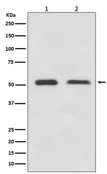 ATF4 Rabbit Monoclonal Antibody