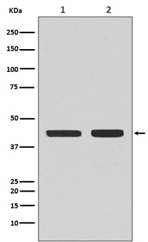 Anti-CCR7 Rabbit Monoclonal Antibody