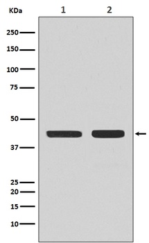 CCR7 Rabbit Monoclonal Antibody