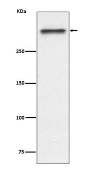 53BP1 TP53BP1 Rabbit Monoclonal Antibody