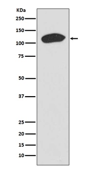 KAP1 TRIM28 Rabbit Monoclonal Antibody