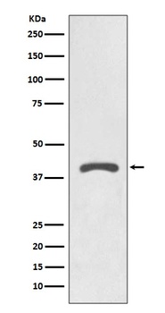 AGTR2/Angiotensin Ii Type 2 Receptor Rabbit Monoclonal Antibody