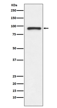 TOP1/Topoisomerase I Rabbit Monoclonal Antibody