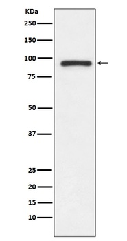 Anti-TOP1/Topoisomerase I Rabbit Monoclonal Antibody