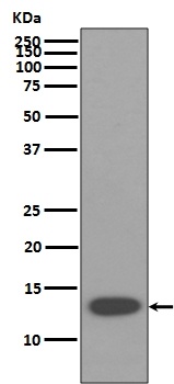 Anti-beta 2 Microglobulin B2M Rabbit Monoclonal Antibody