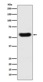 SERPINC1 Monoclonal Antibody