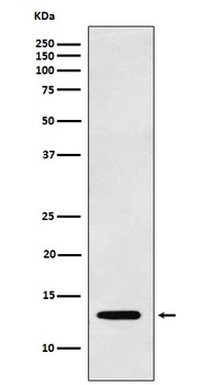 Anti-Galectin 1 LGALS1 Monoclonal Antibody