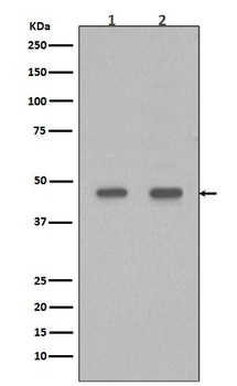 Anti-PDX1/Ipf1 Rabbit Monoclonal Antibody