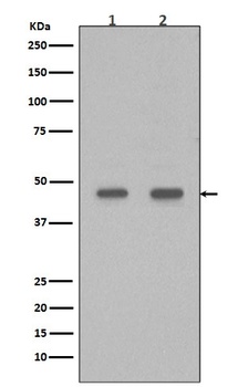 PDX1/Ipf1 Rabbit Monoclonal Antibody