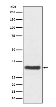 NQO1/Dt Diaphorase Rabbit Monoclonal Antibody