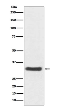 Anti-NQO1/Dt Diaphorase Rabbit Monoclonal Antibody