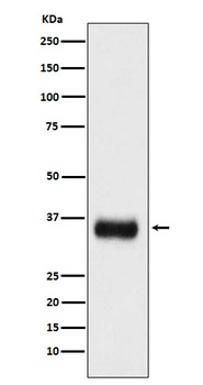 Anti-SF2 Monoclonal Antibody