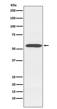 Cytochrome P450 2D6 CYP2D6 Monoclonal Antibody