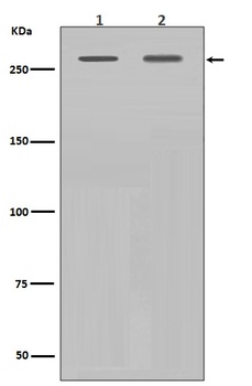 Filamin A FLNA Rabbit Monoclonal Antibody