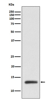 Anti-ROC1 Monoclonal Antibody