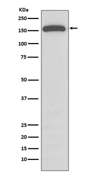 Anti-Gli1 Rabbit Monoclonal Antibody