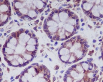 MLKL Rabbit Monoclonal Antibody