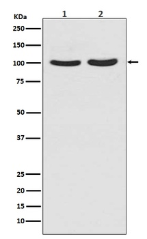 Anti-Androgen Receptor AR Rabbit Monoclonal Antibody