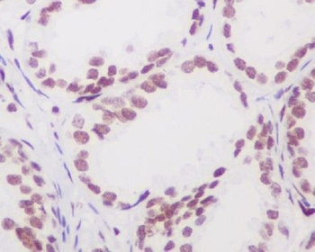 Anti-Androgen Receptor AR Rabbit Monoclonal Antibody