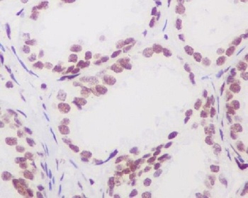 Androgen Receptor AR Rabbit Monoclonal Antibody