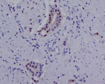 Anti-Androgen Receptor (AR-V7 specific) Rabbit Monoclonal Antibody