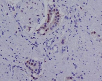 Androgen Receptor (AR-V7 specific) Rabbit Monoclonal Antibody