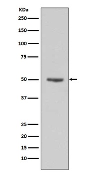 Cyclin E1 CCNE1 Rabbit Monoclonal Antibody
