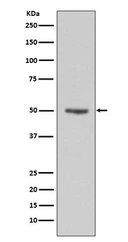 Anti-Cyclin E1 CCNE1 Rabbit Monoclonal Antibody