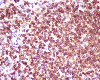 CD45 PTPRC Rabbit Monoclonal Antibody