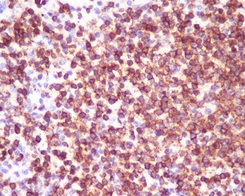 Anti-CD45 PTPRC Rabbit Monoclonal Antibody
