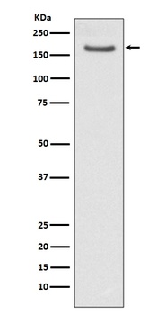 Anti-FANCD2 Rabbit Monoclonal Antibody
