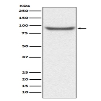 XRCC1 Rabbit Monoclonal Antibody