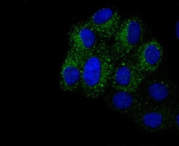 Integrin beta 3 ITGB3 Rabbit Monoclonal Antibody