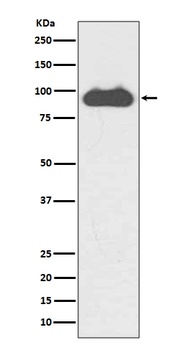 Transferrin Receptor (CD71) TFRC Rabbit Monoclonal Antibody