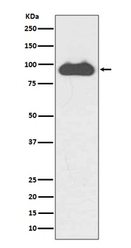 Anti-Transferrin Receptor (CD71) TFRC Rabbit Monoclonal Antibody