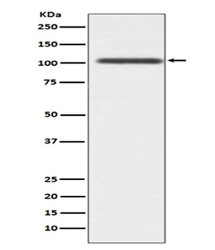 Anti-ADAM17/Tace Rabbit Monoclonal Antibody