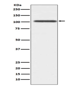 ADAM17/Tace Rabbit Monoclonal Antibody